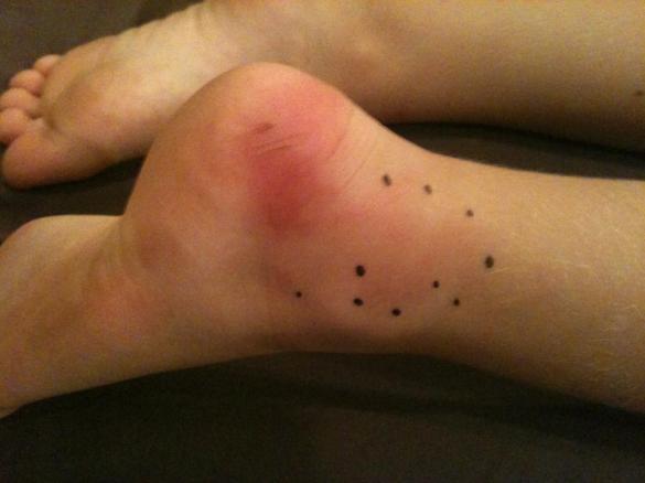 Viikolla huomasimme Piekun kantapäässä olevan haavan melko pahasti tulehtuneen... äiti antoi lääkettä ja kylmää käärettä, ja yksi päivä lepoa, niin alkoi tulehduskin asettua! Vieläkään ei jouduttu käymään Bangkok-Pattaya Hospitalissa!